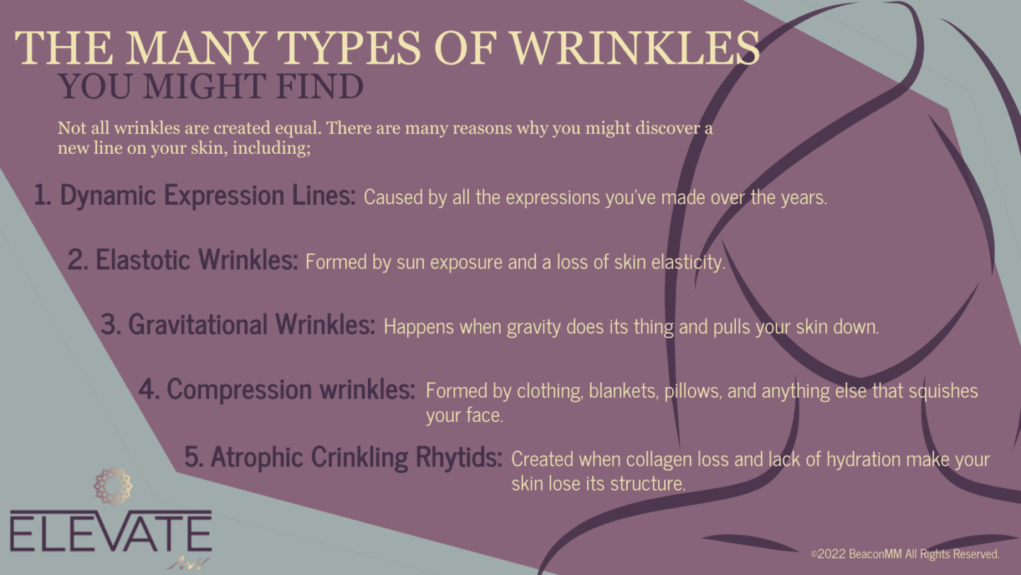 The Many Types of Wrinkles You Might Find Infographic