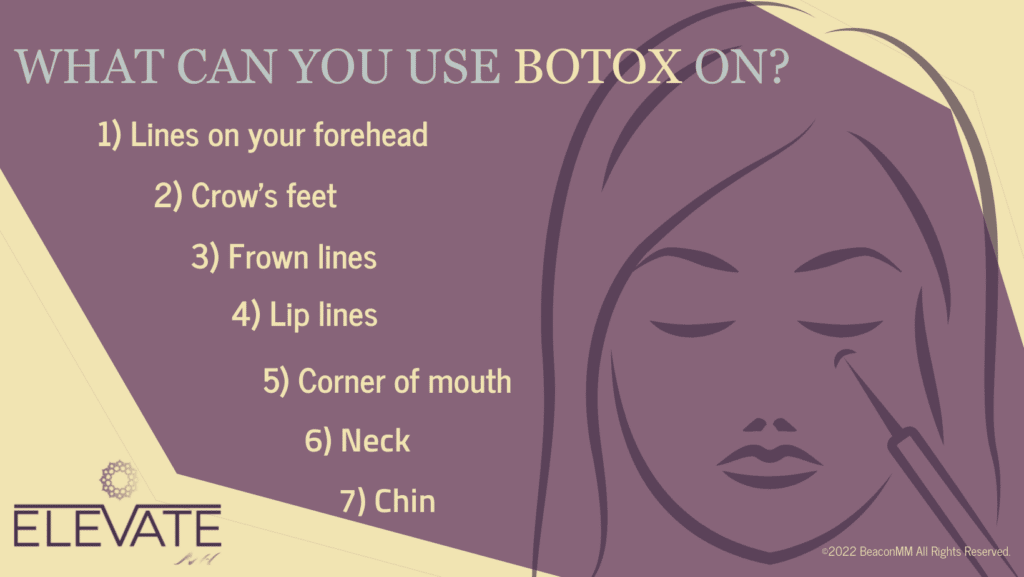 What Can You Use BOTOX® On?  infographic